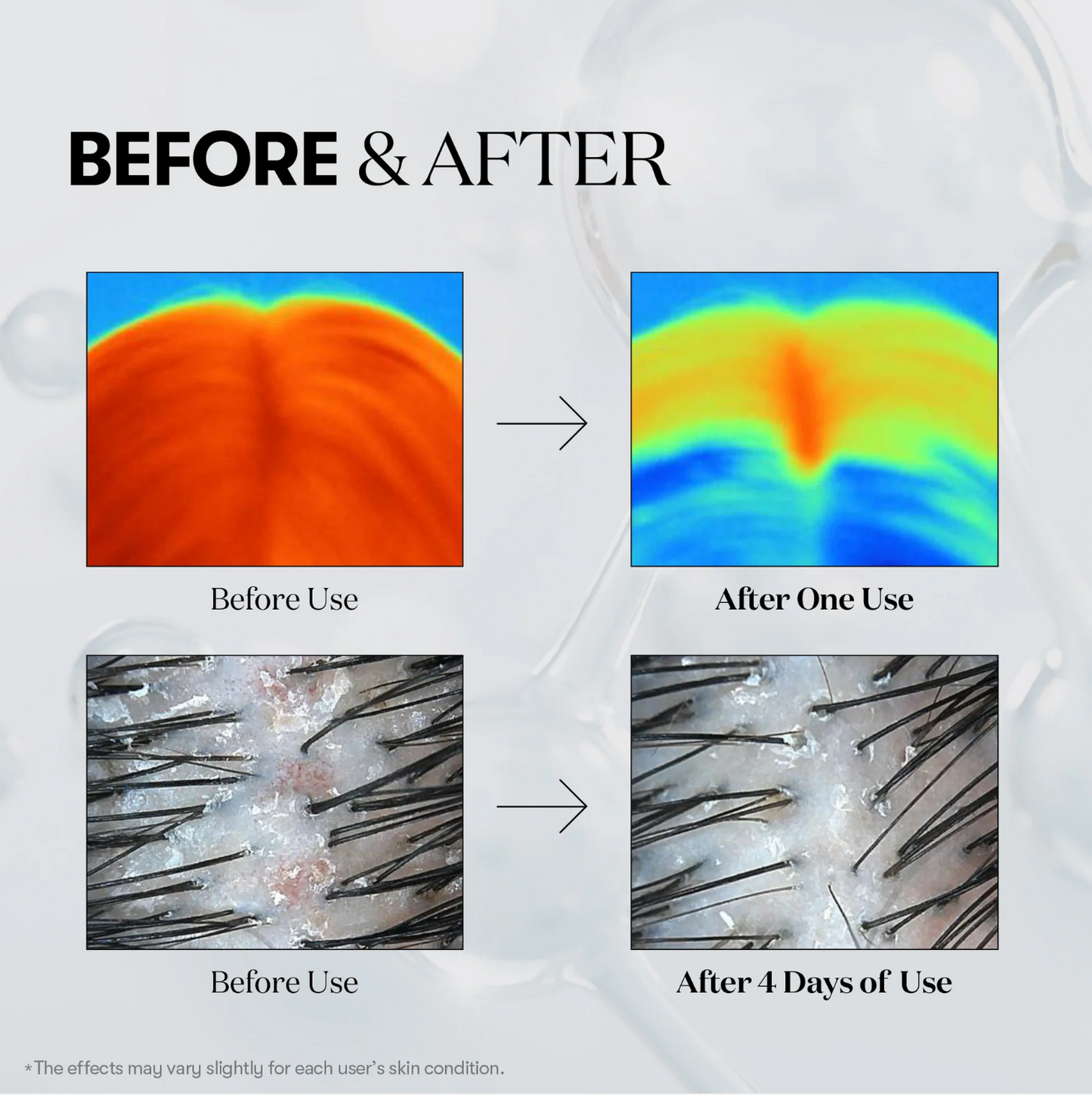 Clofina™ Hair Revival Ampoule