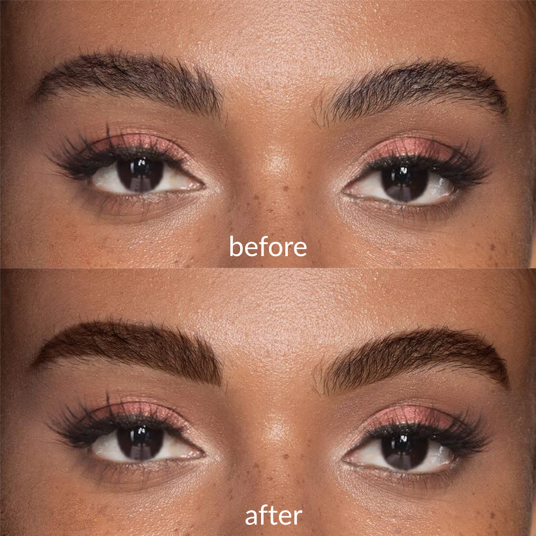 Clofina™ Tattoo Eyebrow Peel