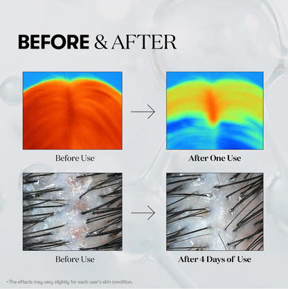 Clofina™ Hair Revival Ampoule